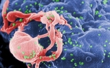 世卫组织称艾滋病毒在东欧地区扩散最快