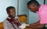 Phiến quân Somalia tấn công khách sạn, giết chết 6 nghị sĩ