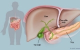 Hepatitis at alarming rate in VN, Asia-Pacific