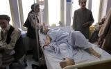 Afghanistan: Tấn công liều chết vào bệnh viện, 35 người thiệt mạng