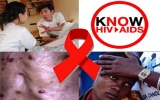 Thế giới chung tay phòng chống HIV/AIDS