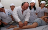Vietnamese scientists prove the good of acupuncture