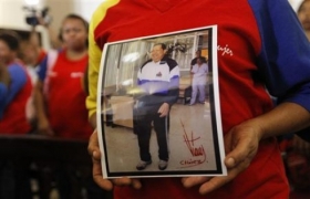 Venezuela's Chavez "improves slightly" after surgery: official