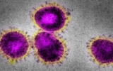Pháp xác nhận ca đầu tiên nhiễm virus giống SARS