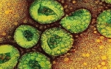 Pháp: Thêm hai ca nghi bị nhiễm virus giống SARS