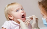 Cách phòng ngừa loét miệng cho trẻ