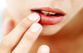 Bốn lý do khiến môi khô nẻ