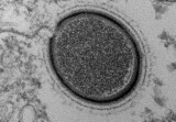 Hồi sinh virus có tuổi thọ 30.000 năm trong băng vĩnh cửu?