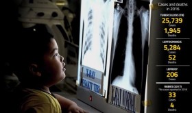 Malaysia worries over return of infectious diseases