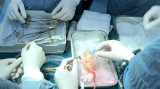 首例儿童患者跨地域器官移植手术取得成功