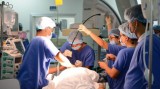 越南掌握经导管主动脉瓣瓣植入术