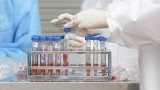 越南研制的新冠病毒检测试剂盒产品获得WHO批准上市