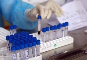 96% ca mắc COVID-19 ở Việt Nam đã bình phục
