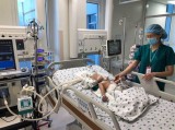 Conjoined twins recover well after separation