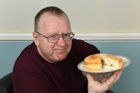 Người đàn ông có dạ dày đặc biệt chuyển hóa mọi thứ thành cồn