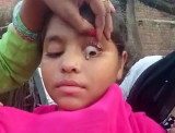 Ấn Độ: Kỳ lạ một bé gái với khả năng khóc ra những viên đá nhỏ