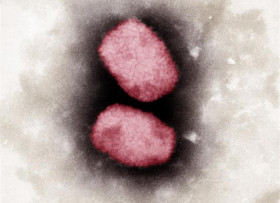 ECDC: Thế giới đã ghi nhận hơn 200 ca mắc bệnh đậu mùa khỉ