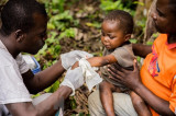 WHO: Bệnh đậu mùa khỉ không gây nguy cơ nghiêm trọng với y tế toàn cầu