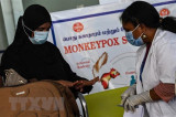 WHO: Bệnh đậu mùa khỉ đã lan ra 78 quốc gia với hơn 18.000 ca