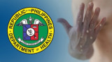 Philippines reports more Mpox cases